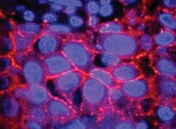 Imagen: Detección inmunohistoquímica del biomarcador para cáncer HER2 (Fotografía cortesía del Instituto Nacional de Estándares y Tecnología).